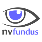 NV Fundus